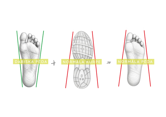 Kas ir hallux valgus un kā tā veidošanos ietekmē apavi